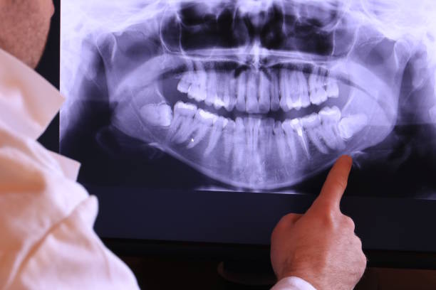 Best Emergency Dental Care for Broken or Chipped Teeth in Discovery Harbour, HI